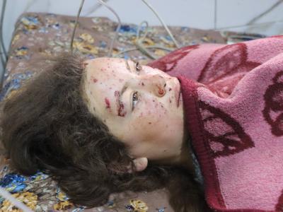 ضحايا مدنيون بهجمات ممنهجة لـ "قوات سوريا الديمقراطية" على ريف منبج